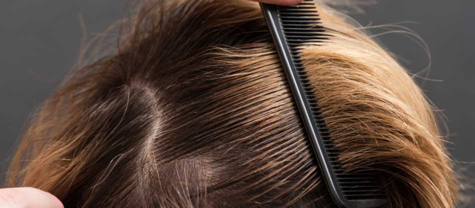 Oily Hair: How To Get Rid Of Oily Hair - Luxy® Hair